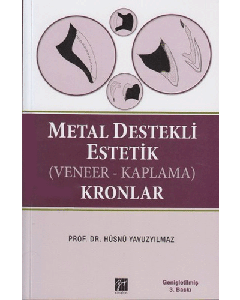 Metal Destekli Estetik (Veneer-Kaplama) Kronlar