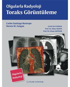 Olgularla Radyoloji Toraks Görüntüleme