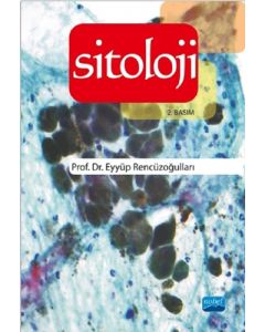 Sitoloji