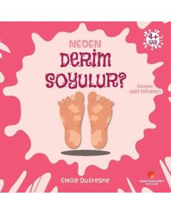 Neden Derim Soyulur? +4 Yaş