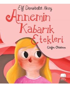 Annemin Kabarık Etekleri
