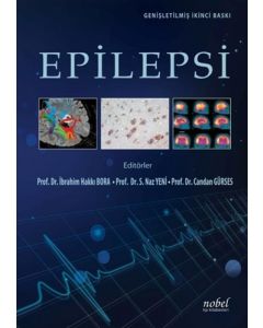 Epilepsi