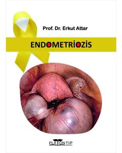 Endometriozis (Ciltli)
