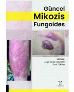 Güncel Mikozis Fungoides